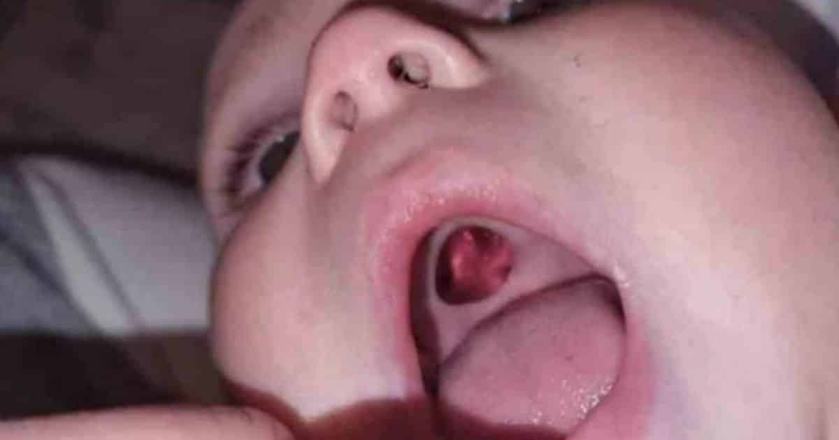 Mom Has Incredibly Awkward Moment After Realizing She Rushed Her Baby to the ER Over a Sticker