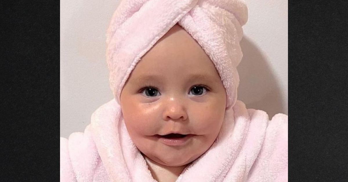 Only 14 Babies with 'Permanent Smile' Condition Have Been Reported and the Latest Is Awing the World