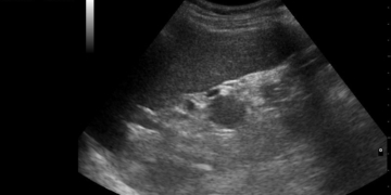 Red States Considering Sex Ed Bills That Would Require Students To Watch Pro-Life Video