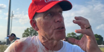 Emergency Room Doctor Attempted To Save Life Of Man Shot At Trump Rally